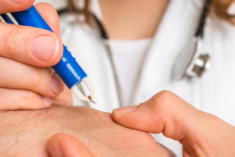 A doctor carefully tweezing a tick off of her patient